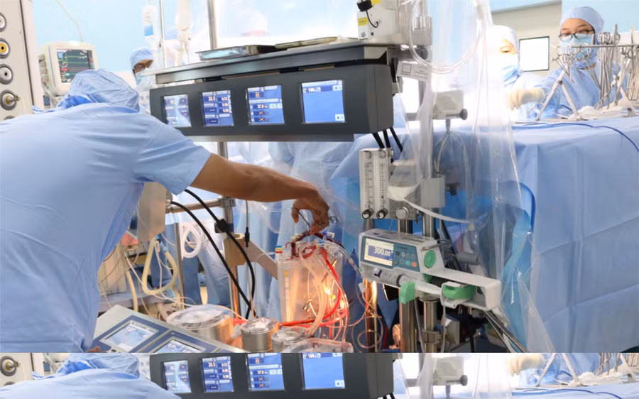 Ê-kíp tuần hoàn ngoài cơ thể Viện Tim – BV Quận Thủ Đức