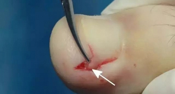 Móng có chức năng bảo vệ, giúp mạng lưới thần kinh dày đặc ở các đầu chi khỏi bị tổn thương.