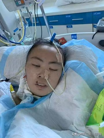 nguoi phu nu 26 tuoi khong tinh day sau 40 ngay mac loai benh de nham voi cam lanh - 3