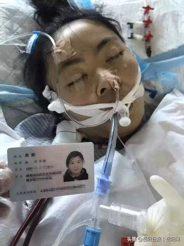 nguoi phu nu 26 tuoi khong tinh day sau 40 ngay mac loai benh de nham voi cam lanh - 1