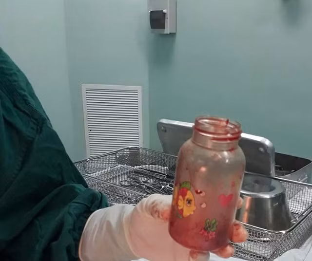 Dùng bình sữa chữa.... thoái hóa cột sống