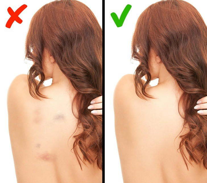 7 tín hiệu nhỏ trên cơ thể nhưng lại tiết lộ những vấn đề lớn về sức khỏe, dấu hiệu thứ 3 có thể cảnh báo bệnh ung thư - Ảnh 3.