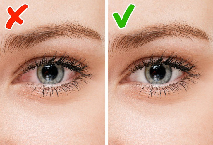 7 tín hiệu nhỏ trên cơ thể nhưng lại tiết lộ những vấn đề lớn về sức khỏe, dấu hiệu thứ 3 có thể cảnh báo bệnh ung thư - Ảnh 5.