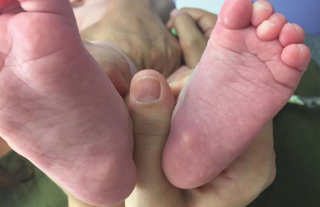 Ký ức ám ảnh của một bác sĩ nhi khoa chuẩn đoán sai làm hại chết một đứa trẻ gây bão MXH - Ảnh 4. Ký ức ám ảnh của một bác sĩ nhi khoa chuẩn đoán sai làm hại chết một đứa trẻ gây bão MXH - Ảnh 4.