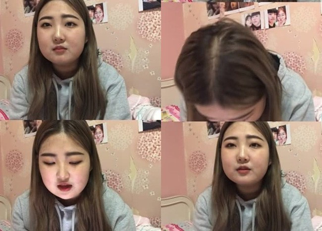 Con gai co dien vien Choi Jin Sil tang 10 kg vi mac benh kho chua hinh anh 1