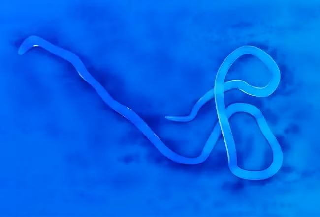 Ký sinh trùng có thể sống nhiều năm trong ruột mà không gây ra bất kỳ triệu chứng nào. (Ảnh: ITN) Ký sinh trùng có thể sống nhiều năm trong ruột mà không gây ra bất kỳ triệu chứng nào. (Ảnh: ITN)