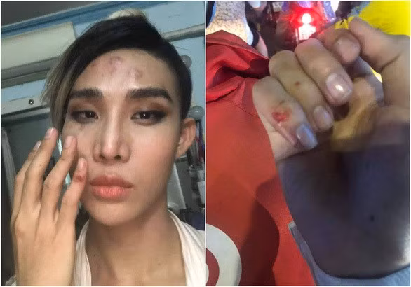 Hình ảnh Mid Nguyễn chia sẻ trên mạng xã hội.
