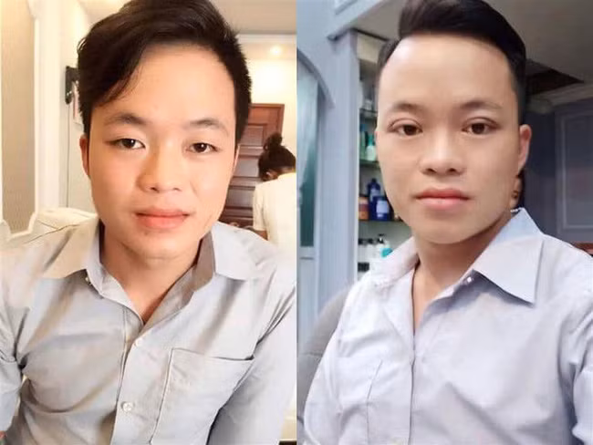 Chồng cô dâu 62 tuổi gây sốc với diện mạo mới sau khi được vợ chơi lớn cho đi tân trang nhan sắc-5