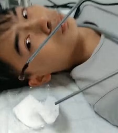 Bệnh nhân không hề biết rằng có đỉa trú ngụ trong mũi mình 
