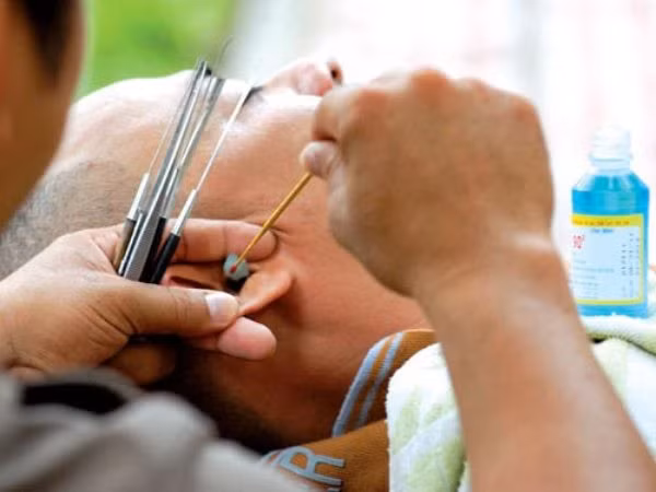 Rước bệnh vì thói quen tỉa lông mũi, lấy ráy tai ngoài hàng