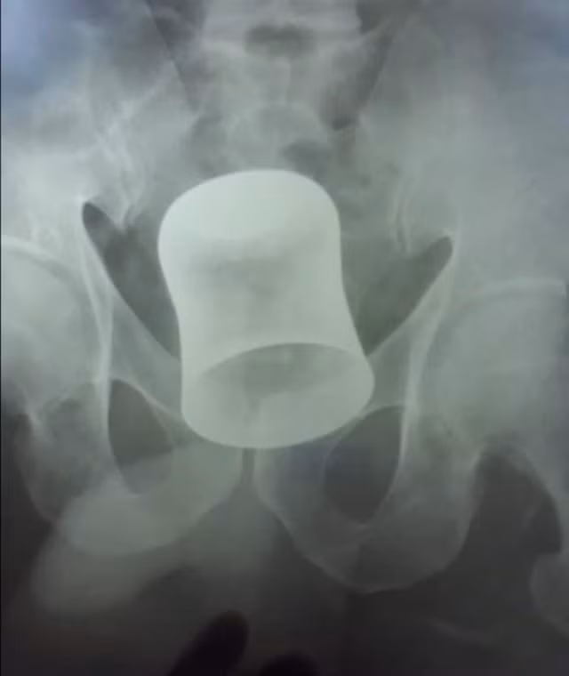 Ông bị tấn công vào tháng 6 vừa rồi