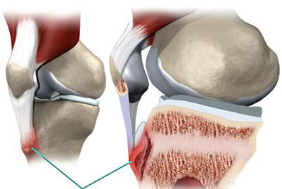 dau-dau-goi-o-tuoi-thieu-nien-1