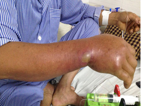 Cắt cỏ cá tại bờ ruộng, 5 ngày sau người đàn ông suýt mất mạng vì lý do không ngờ ảnh 1 Cắt cỏ cá tại bờ ruộng, 5 ngày sau người đàn ông suýt mất mạng vì lý do không ngờ ảnh 1