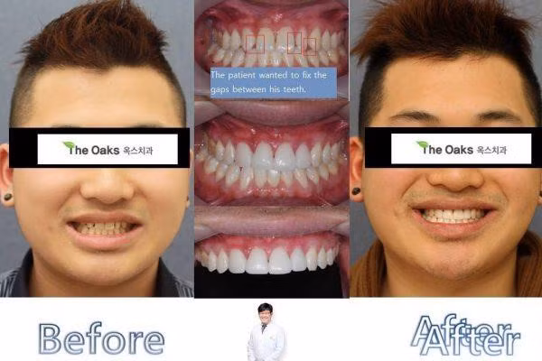 9 xu hướng phẫu thuật thẩm mỹ phổ biến nhất ở Hàn Quốc-8