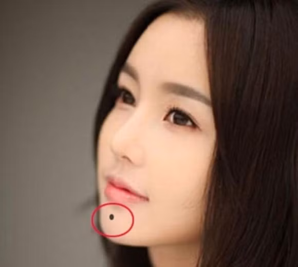 5 vị trí nốt ruồi phú quý trên khuôn mặt tuyệt đối không tẩy xóa ảnh 3