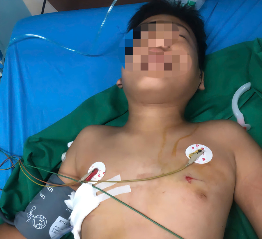 Em Trần Tấn P. (13 tuổi) trú hẻm 20 Nguyễn Khoa Đăng, phường Thành Nhất, Đắk Lắk được cấp cứu tại bệnh viện.