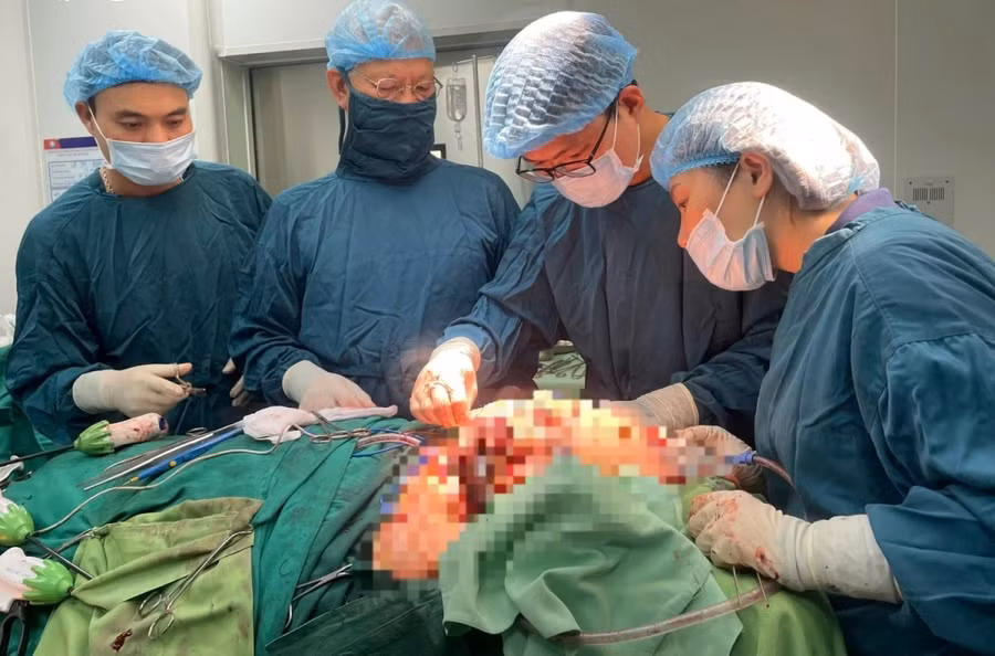 Bệnh nhân được phẫu thuật khối u máu khổng lồ vùng mặt.