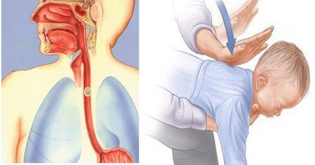 Những người nào có nguy cơ mắc dị vật trong đường tiêu hóa.