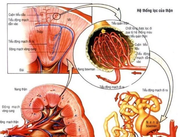 Bệnh thận mạn tính thường phát hiện muộn.