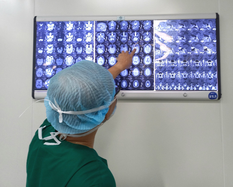 Bác sĩ xem ảnh chụp các khối u não trước khi mổ cho anh Khương. (Ảnh: BVCC). Bác sĩ xem ảnh chụp các khối u não trước khi mổ cho anh Khương. (Ảnh: BVCC).