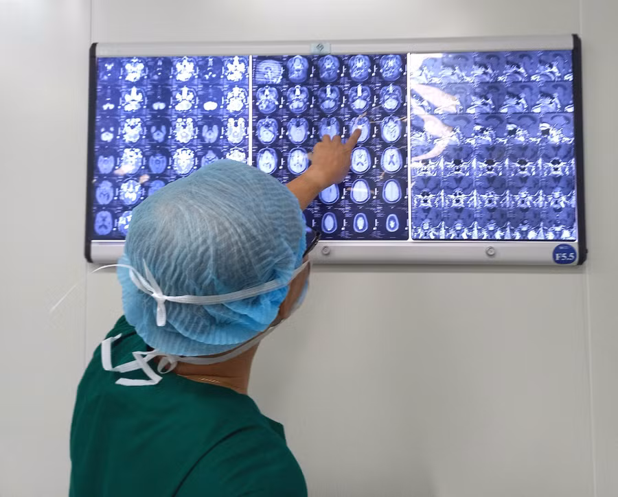 Bác sĩ xem ảnh chụp các khối u não trước khi mổ cho anh Khương. (Ảnh: BVCC).