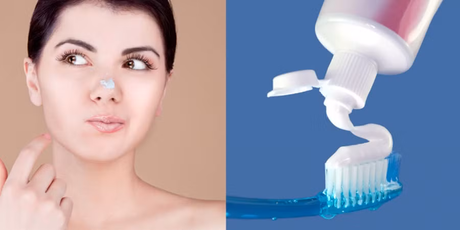 (Ảnh minh họa internet)