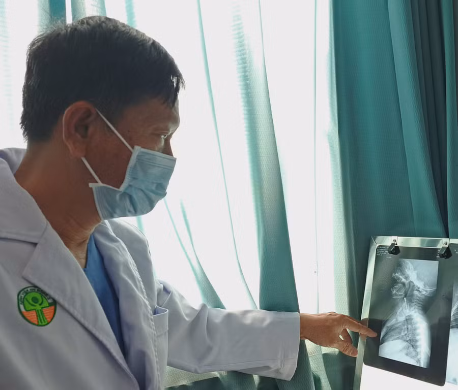 Hình ảnh X-quang cho thấy kim băng bung ra trong thực quản bé trai. (Ảnh: BVCC)