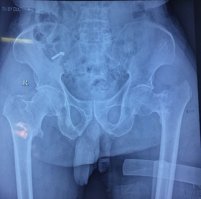 Hình ảnh phim chụp