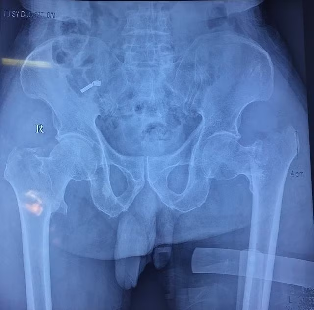 Hình ảnh phim chụp