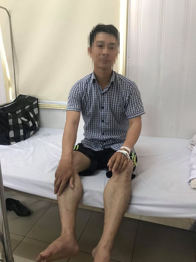 Anh K khỏe hơn sau hai tuần điều trị Anh K khỏe hơn sau hai tuần điều trị