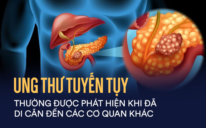 Ảnh minh họa. 