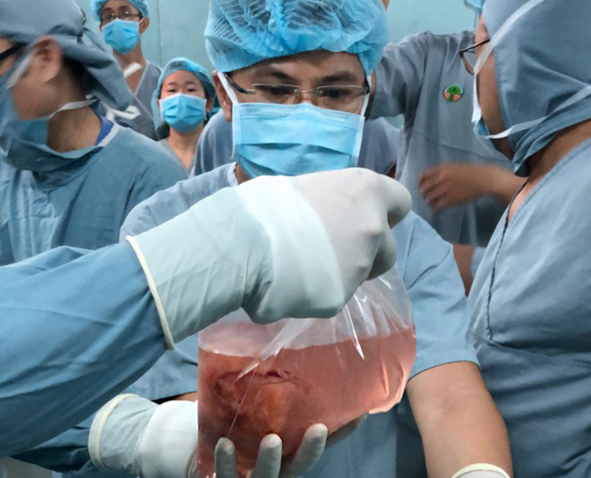 Quả thận được vận chuyển từ Hà Nội vào TPHCM qua đường hàng không an toàn để ghép cho bệnh nhi H. Quả thận được vận chuyển từ Hà Nội vào TPHCM qua đường hàng không an toàn để ghép cho bệnh nhi H.