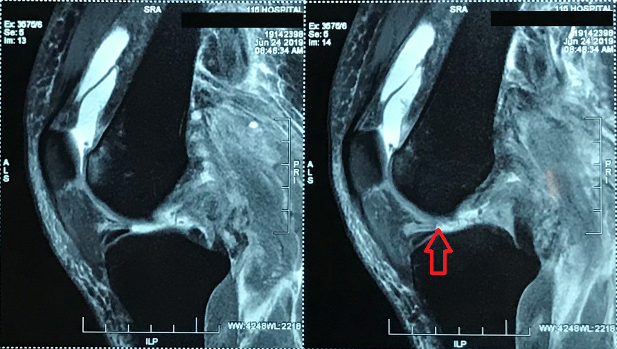 Hình ảnh phim chụp. Hình ảnh phim chụp.