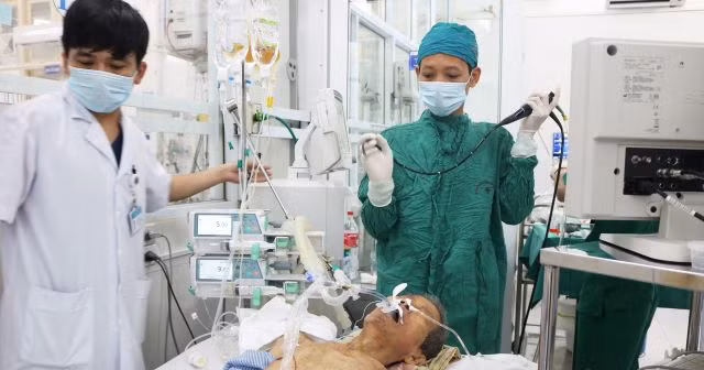 Các bác sĩ tiến hành gắp dị vật ra ngoài (BVCC).