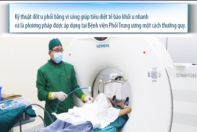 Phương pháp đốt u phổi bằng vi sóng (Ảnh BV cung cấp).