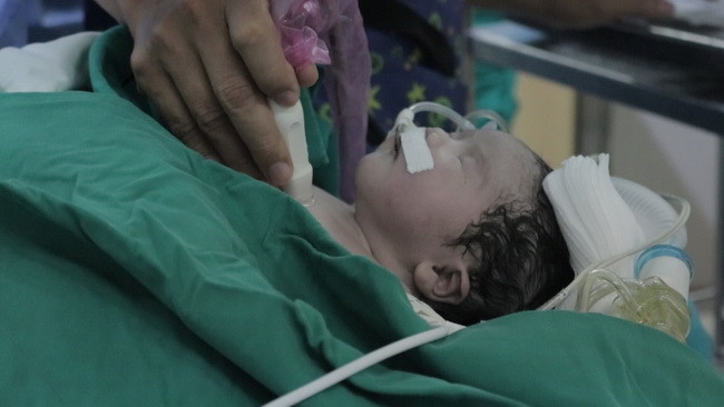 Bé sơ sinh được can thiệp cấp cứu phá vách liên nhĩ bằng bóng qua da (Ảnh:BVCC) Bé sơ sinh được can thiệp cấp cứu phá vách liên nhĩ bằng bóng qua da (Ảnh:BVCC)