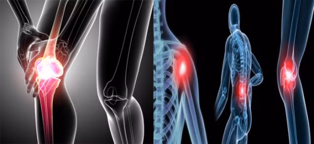 Bệnh nhân ung thư xương không còn lo bị tháo khớp hay cắt bỏ chân