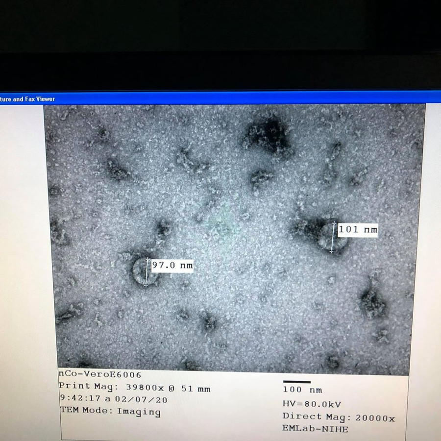 Việt Nam nuôi cấy và phân lập thành công virus corona mới
