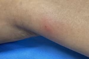 Các chuyên gia cảnh báo thói quen ăn đồ sống.