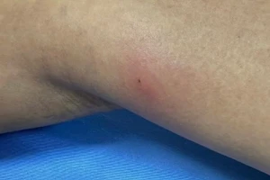Các chuyên gia cảnh báo thói quen ăn đồ sống.