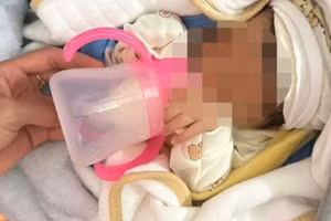 Bé gái khoảng 1 tuần tuổi bị bỏ rơi giữa đêm đông lạnh. (Ảnh: NDCC)