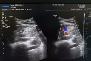 Đi khám định kỳ, người đàn ông 32 tuổi phát hiện ung thư thận. (Ảnh: NVCC)