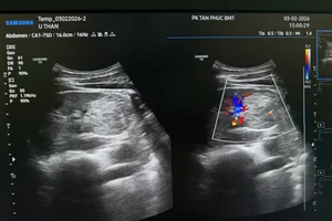 Đi khám định kỳ, người đàn ông 32 tuổi phát hiện ung thư thận. (Ảnh: NVCC)