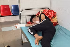Em P.V.D. bị đánh gãy tay, vỡ đầu phải khâu 12 mũi. (Ảnh: NN)