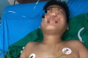 Em Trần Tấn P. (13 tuổi) trú hẻm 20 Nguyễn Khoa Đăng, phường Thành Nhất, Đắk Lắk được cấp cứu tại bệnh viện.
