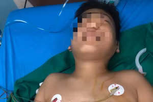 Em Trần Tấn P. (13 tuổi) trú hẻm 20 Nguyễn Khoa Đăng, phường Thành Nhất, Đắk Lắk được cấp cứu tại bệnh viện.