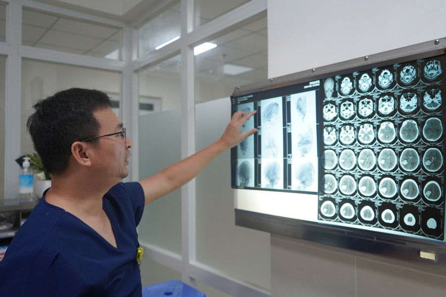Bác sĩ chỉ hình ảnh dị dạng mạch máu não trước phẫu thuật. hinh-anh-di-dang-mach-mau-nao-truoc-phau-thuat.jpg