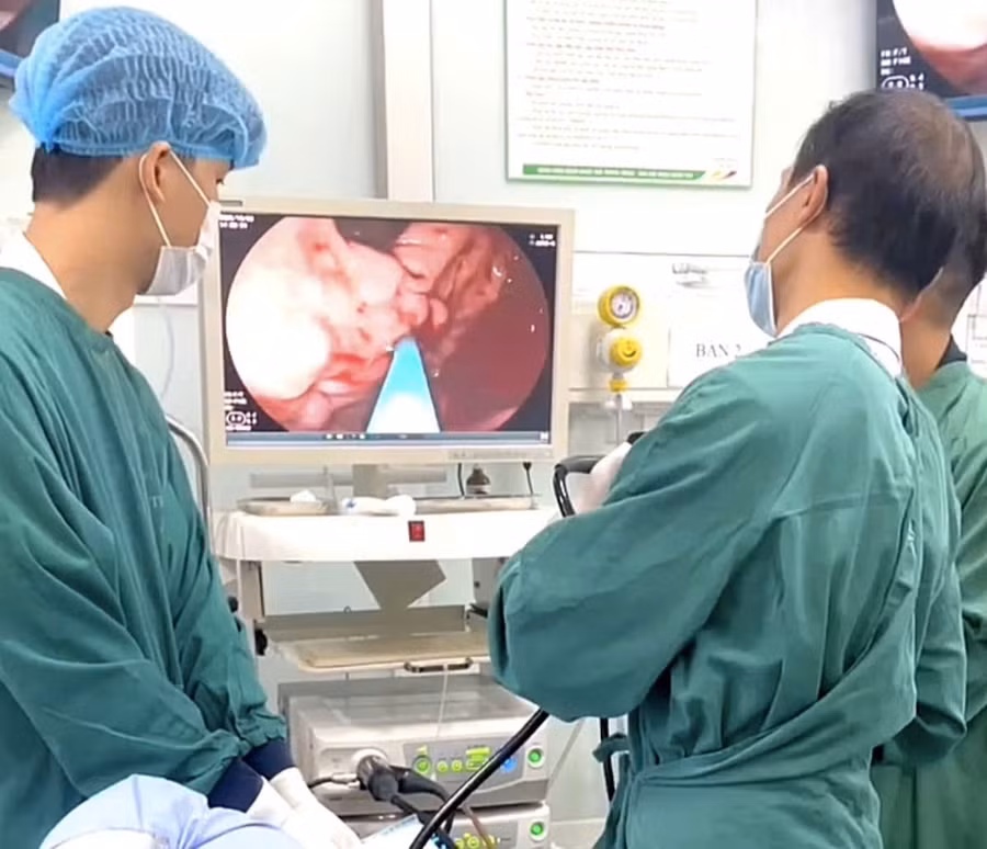 Bệnh nhân được chỉ định nội soi tiêu hóa thăm dò chức năng để tìm điểm xuất huyết. Ảnh: BVCC
