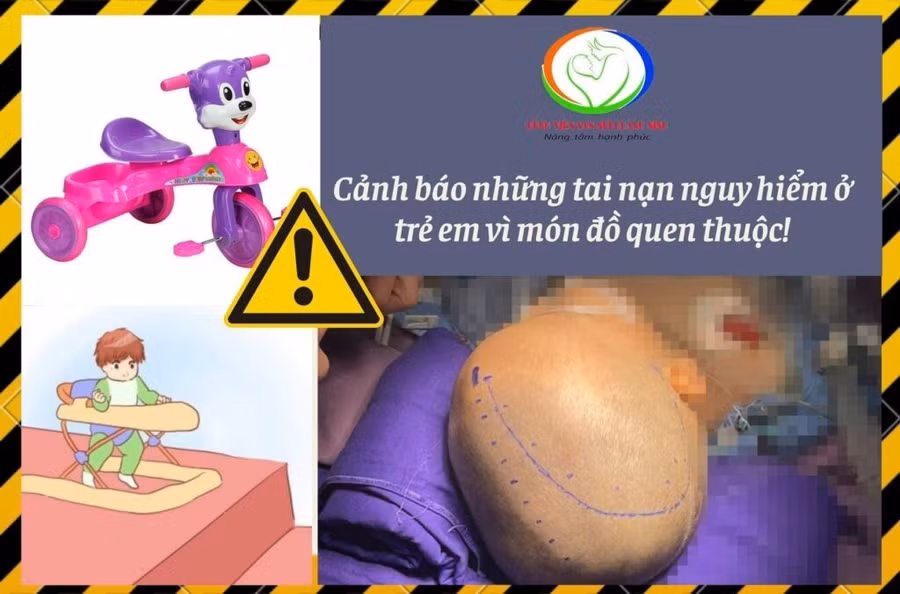 Bác sĩ cảnh báo, xe tập đi, xe 3 bánh không có dây bảo hiểm có thể gây nguy hiểm cho trẻ. Ảnh: BV
