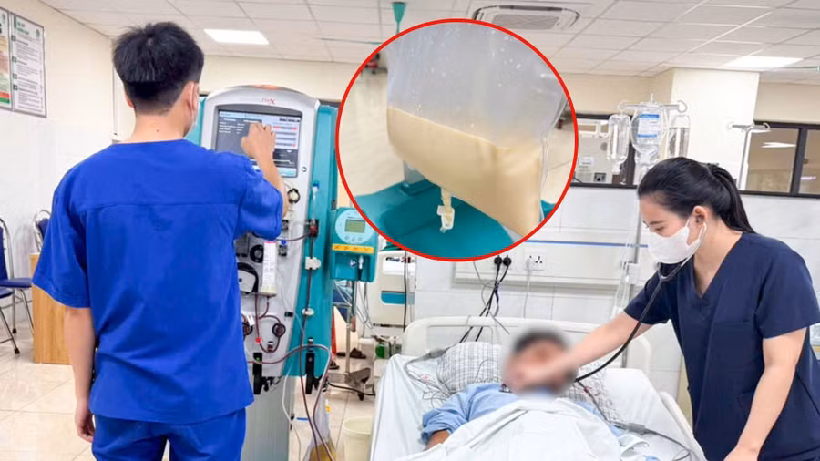 Bệnh nhân bị viêm tụy cấp do tăng Triglycerid (tăng mỡ máu). Ảnh: INT
